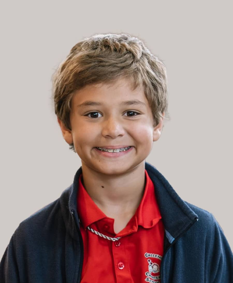 Smiling child—Kids orthodontics