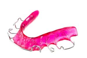 Retainers Peoria AZ