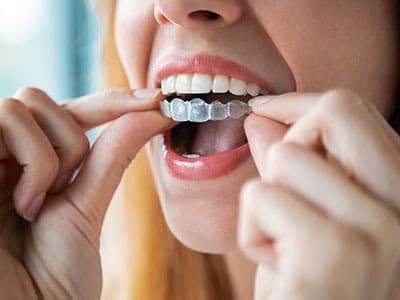 glendale orthodontics