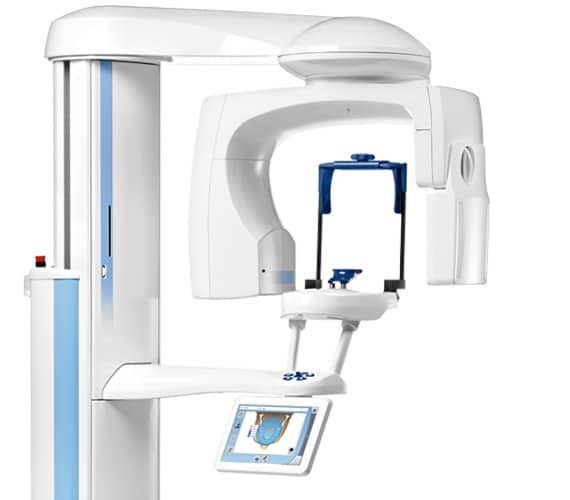 ConeBeam 3D Imaging Teeters Orthodontics in Peoria, AZ