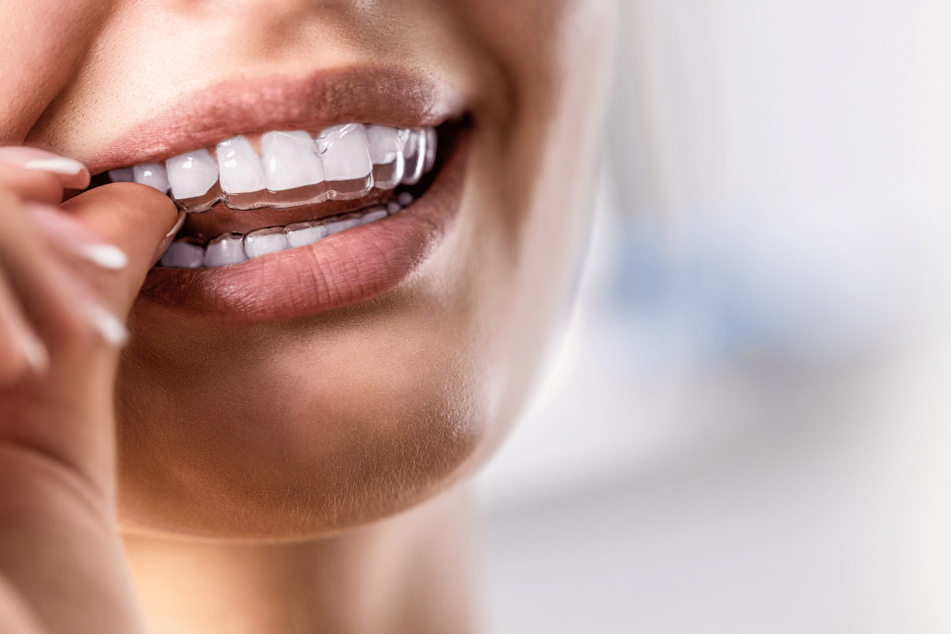 orthodontist surprise