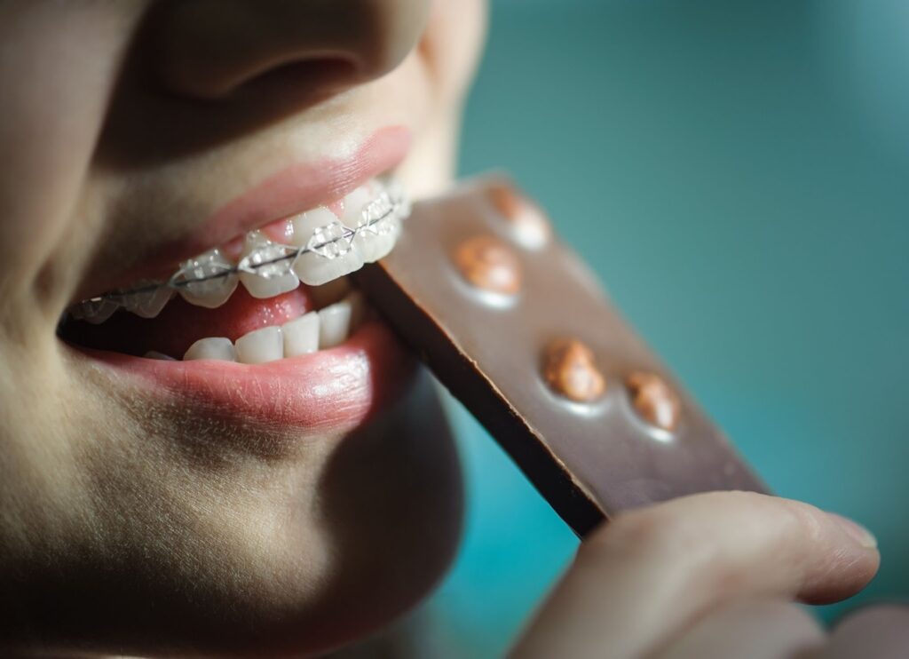 A Beginner’s Guide to Clear Braces
